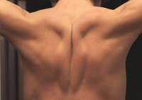 Bolesť chrbta je najčastejšou civilizačnou chorobou.